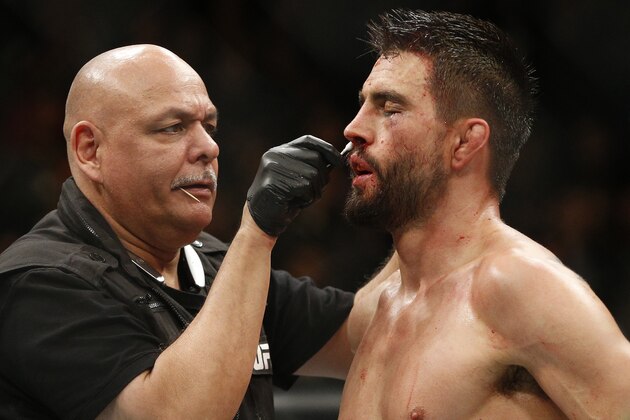 Carlos Condit after a loss to Robbie Lawler during a welterweight championship mixed martial arts bout at UFC 195, Saturday, Jan. 2, 2016, in Las Vegas. (AP Photo/John Locher)