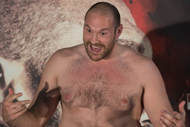 Britain's Tyson Fury, the heavyweight world boxing champion shows off his body to illustrate his lack of conditioning as he attends a press conference in Manchester, England, Wednesday, April 27, 2016. Fury is scheduled for a rematch against and Ukrainian Wladimir Klitschko on Saturday July 9 at the Manchester Arena. (AP Photo/Jon Super)
