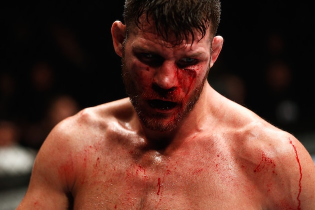 LONDON, ENGLAND - FEBRUARY 27:  A bloody and battered Michael 'The Count' Bisping of England compete in their Middleweight bout against  Anderson 'The Spider' Silva of Brazil during the UFC Fight Night held at at Indigo at The O2 Arena on February 27, 2016 in London, England.  (Photo by Dean Mouhtaropoulos/Zuffa LLC/Zuffa LLC via Getty Images)