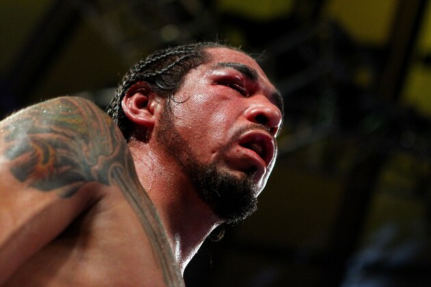NEW YORK, NY - DECEMBER 03:  Antonio Margarito of Mexico right eye appears swollen shut while fighting against Miguel Cotto of Puerto Rico against  in the X round during the WBA World Junior Middleweight Title fight at Madison Square Garden on December 3, 2011 in New York City.  (Photo by Al Bello/Getty Images)