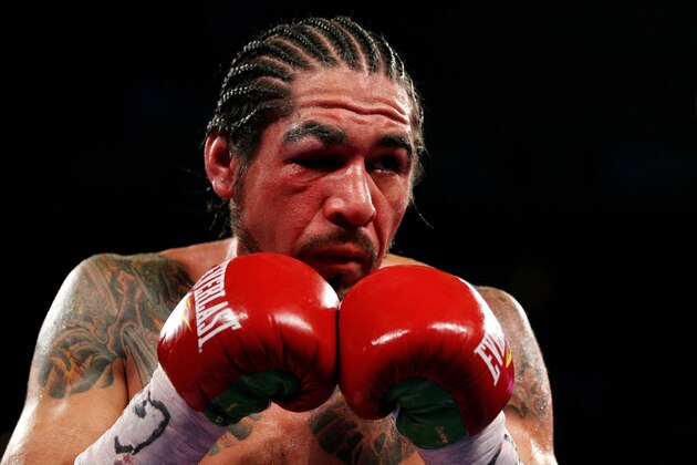 NEW YORK, NY - DECEMBER 03:  Antonio Margarito of Mexico right eye appears swollen shut while fighting against Miguel Cotto of Puerto Rico against  in the X round during the WBA World Junior Middleweight Title fight at Madison Square Garden on December 3, 2011 in New York City.  (Photo by Al Bello/Getty Images)