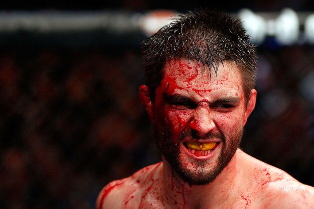 MONTREAL, QC - NOVEMBER 17:  A cut and bloodied Carlos Condit reacts after a round against Georges St-Pierre in their welterweight title bout during UFC 154 on November 17, 2012  at the Bell Centre in Montreal, Canada.  (Photo by Josh Hedges/Zuffa LLC/Zuffa LLC via Getty Images)