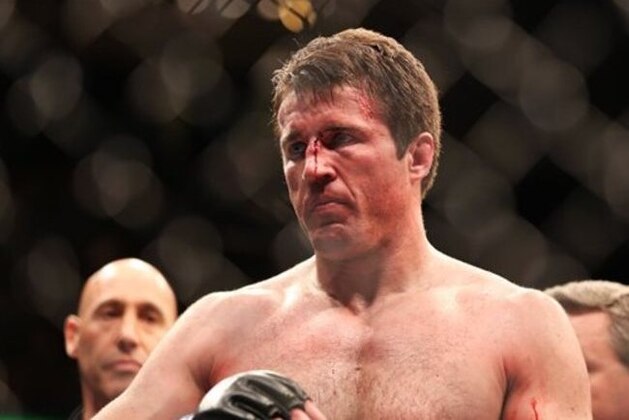 FILE - In this April 27, 2013, file photo, Chael Sonnen is shown after losing to champion Jon Jones in a UFC 159 Mixed Martial Arts light heavyweight title bout in Newark, N.J. Four months after Sonnen's performance-enhancing drug use got him kicked out of the octagon and off television, the ex-UFC middleweight is getting another chance to tell the world about his sport. Sonnen has joined ESPN as a mixed martial arts analyst, returning to broadcast media after he was fired by Fox and suspended from fighting by the Nevada Athletic Commission during the summer. (AP Photo/Gregory Payan, File)