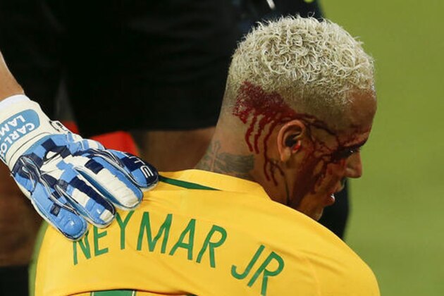 Bolivia goalie Carlos Emilio Lampe, right, checks on Brazil’s Neymar as he lies on the pitch with his face bleeding after a rough play during a 2018 World Cup qualifying soccer match against Bolivia, in Natal, Brazil, Thursday, Oct. 6, 2016. Brazil won the match 5-0. (AP Photo/Leo Correa)