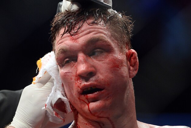 Mar 4, 2017; Las Vegas, NV, USA; Darren Elkins is tended to in-between rounds against Mirsad Bektic (not pictured) during their bout at UFC 209 at T-Mobile Arena. Elkins won via third round TKO. Mandatory Credit: Joe Camporeale-USA TODAY Sports