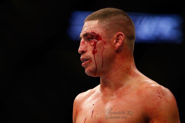 HOUSTON, TEXAS - OCTOBER 19:  Diego Sanchez looks on during his fight against Gilbert Melendez (not pictured) in their UFC lightweight bout at the Toyota Center on October 19, 2013 in Houston, Texas. (Photo by Josh Hedges/Zuffa LLC/Zuffa LLC via Getty Images)