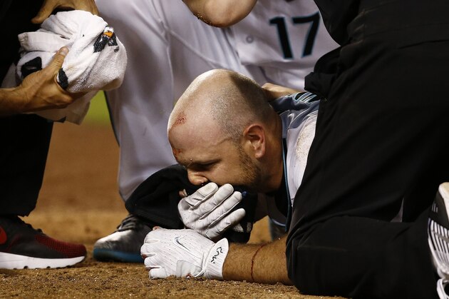 Arizona Diamondbacks' Chris Iannetta is attended to after being hit in the face with a pitch during the seventh inning of a baseball game against the Pittsburgh Pirates Friday, May 12, 2017, in Phoenix. The Diamondbacks defeated the Pirates 11-4. (AP Photo/Ross D. Franklin)
