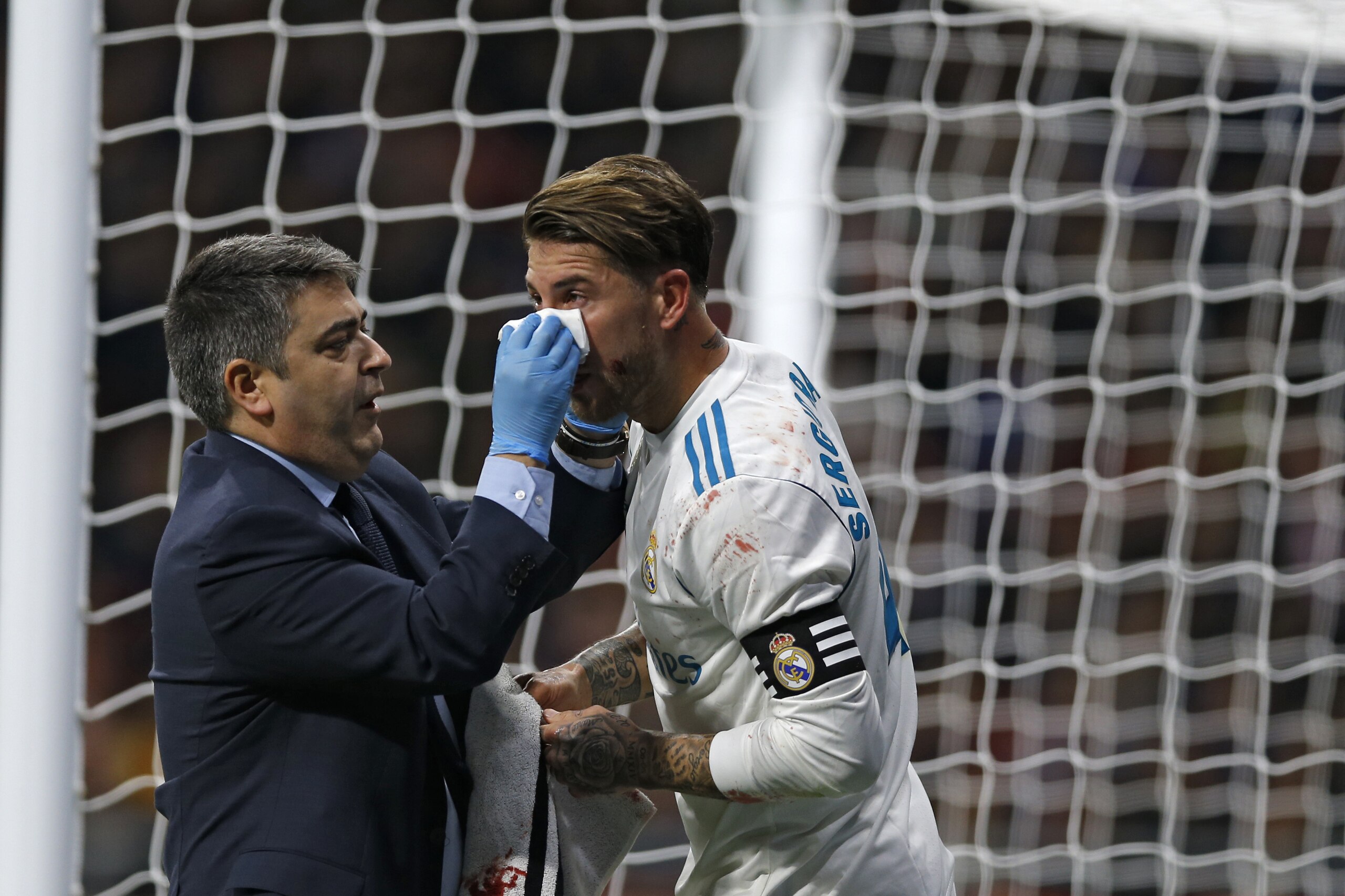 Real Madrid's Sergio Ramos, right, with his jersey stained with blood is cared for by a team's doctor during the Spanish La Liga soccer match between Real Madrid and Atletico at the Wanda Metropolitano stadium in Madrid, Saturday, Nov 18, 2017. (AP Photo/Francisco Seco)