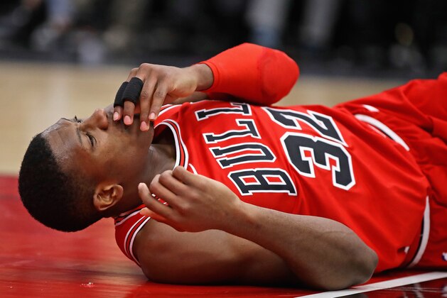 CHICAGO, IL - JANUARY 17:  Kris Dunn #32 of the Chicago Bulls lays on the floor after suffering a mouth injury following a dunk against the Golden State Warriors at the United Center on January 17, 2018 in Chicago, Illinois. The Warriors defeated the Bulls 119-112. NOTE TO USER: User expressly acknowledges and agrees that, by downloading and or using this photograph, User is consenting to the terms and conditions of the Getty Images License Agreement.  (Photo by Jonathan Daniel/Getty Images)