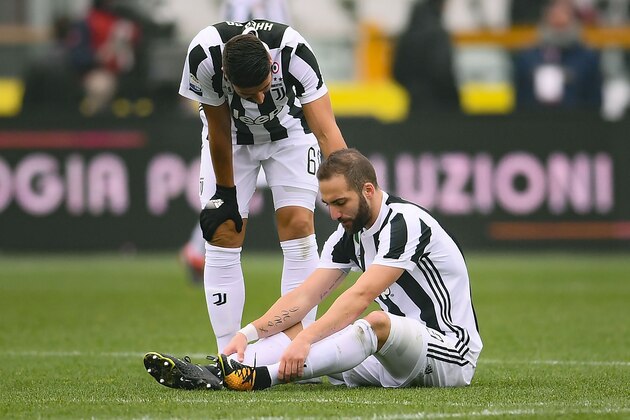 Juventus' Argentinian forward Gonzalo Higuain (R) reacts near Juventus' German midfielder Sami Khedira during the Italian Serie A football match Torino vs Juventus on February 18, 2018 at the 'Stadio Grande Torino' in Turin. / AFP PHOTO / MARCO BERTORELLO        (Photo credit should read MARCO BERTORELLO/AFP/Getty Images)