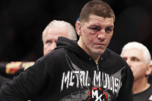 FILE - In this Feb. 4, 2012, file photo, Nick Diaz stands after Carlos Condit won a unanimous decision in their UFC welterweight mixed martial arts bout in Las Vegas. The head of the Nevada Athletic Commission says Diaz tested positive for marijuana after his recent loss to Condit and faces disciplinary action, including a possible suspension and fine. Executive director Keith Kizer said Thursday, Feb. 9, 2012. that Diaz's license has been temporarily suspended and he will have 20 days to respond to the allegations. (AP Photo/Eric Jamison, File)