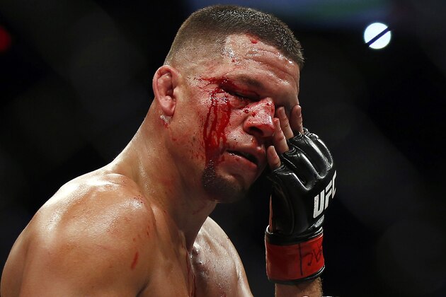 Nate Diaz wipes blood from his eyes during his welterweight mixed martial arts bout against Conor McGregor at UFC 202 on Saturday, Aug. 20, 2016, in Las Vegas.  McGregor won by split decision. (AP Photo/Isaac Brekken)