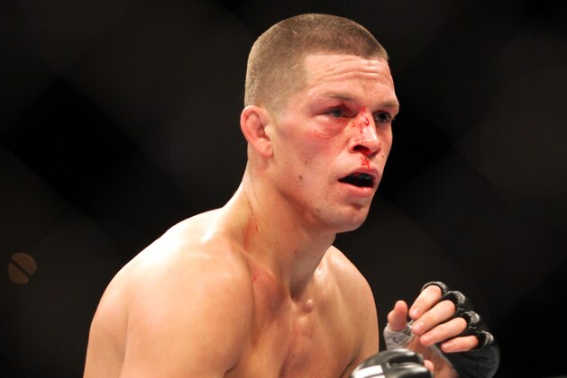 Nate Diaz is seen during his match against UFC lightweight champion Benson Henderson in their mixed martial arts bout at a UFC on FOX 5 event in Seattle, Saturday, Dec. 8, 2012. Henderson retained his title via unanimous 5-rd. decision. (AP Photo/Gregory Payan)