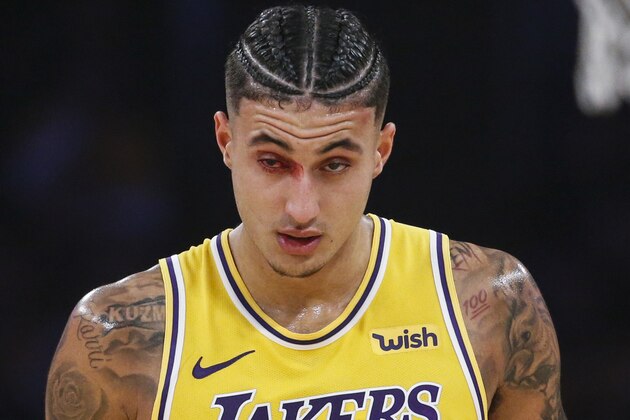 Los Angeles Lakers' Kyle Kuzma walks off the court as blood trickles from his eye during the first half of the team's NBA basketball game agains the Oklahoma City Thunder, Tuesday, Nov. 19, 2019, in Los Angeles. (AP Photo/Ringo H.W. Chiu)