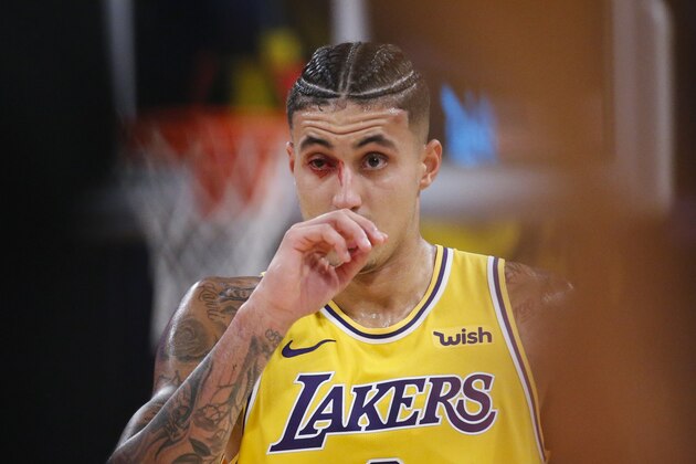 Los Angeles Lakers' Kyle Kuzma walks off the court as blood trickles from his eye during the first half of the team's NBA basketball game agains the Oklahoma City Thunder, Tuesday, Nov. 19, 2019, in Los Angeles. (AP Photo/Ringo H.W. Chiu)