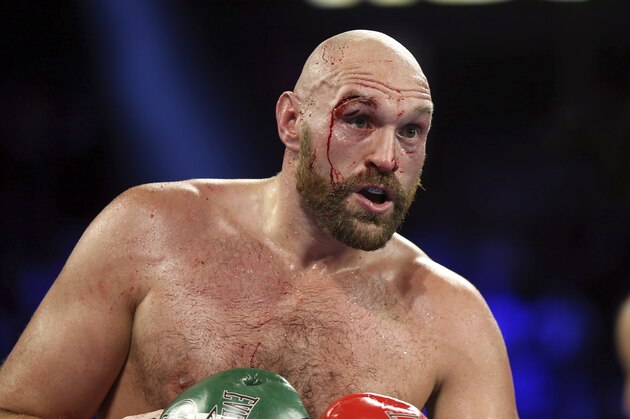 Tyson Fury, of England, displays a cut over his right eye following a heavyweight boxing match against Otto Wallin, of Sweden, Saturday, Sept. 14, 2019, in Las Vegas. Fury won by unanimous decision. (AP Photo/Isaac Brekken)