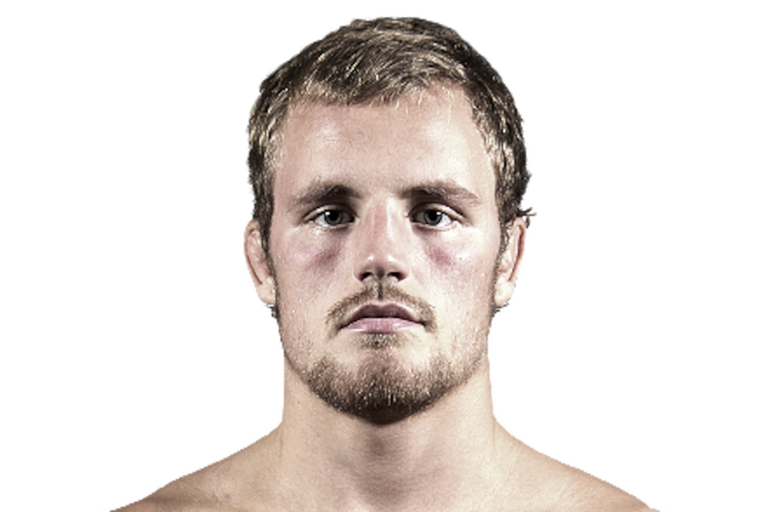 Gunnar Nelson