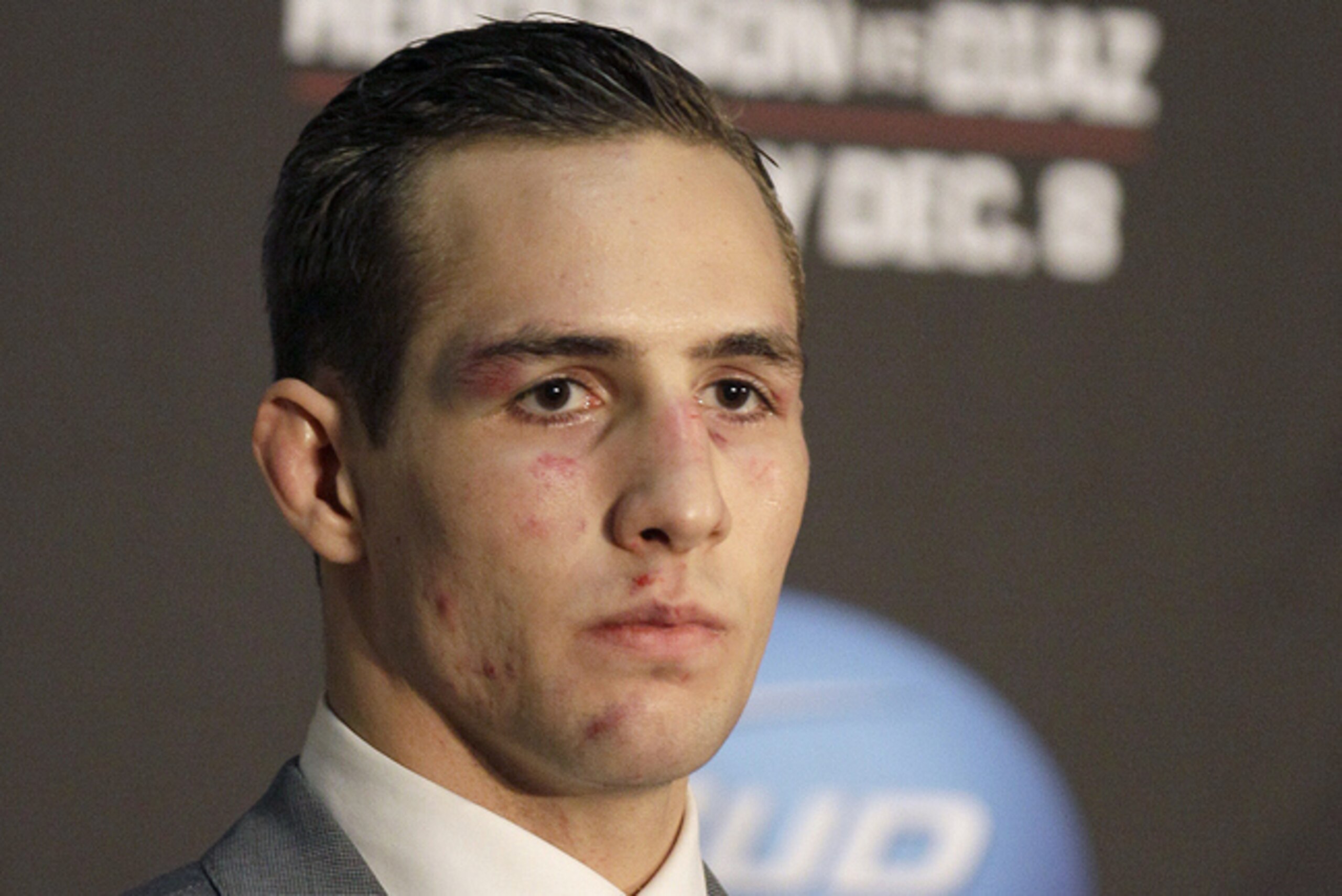 Rory MacDonald