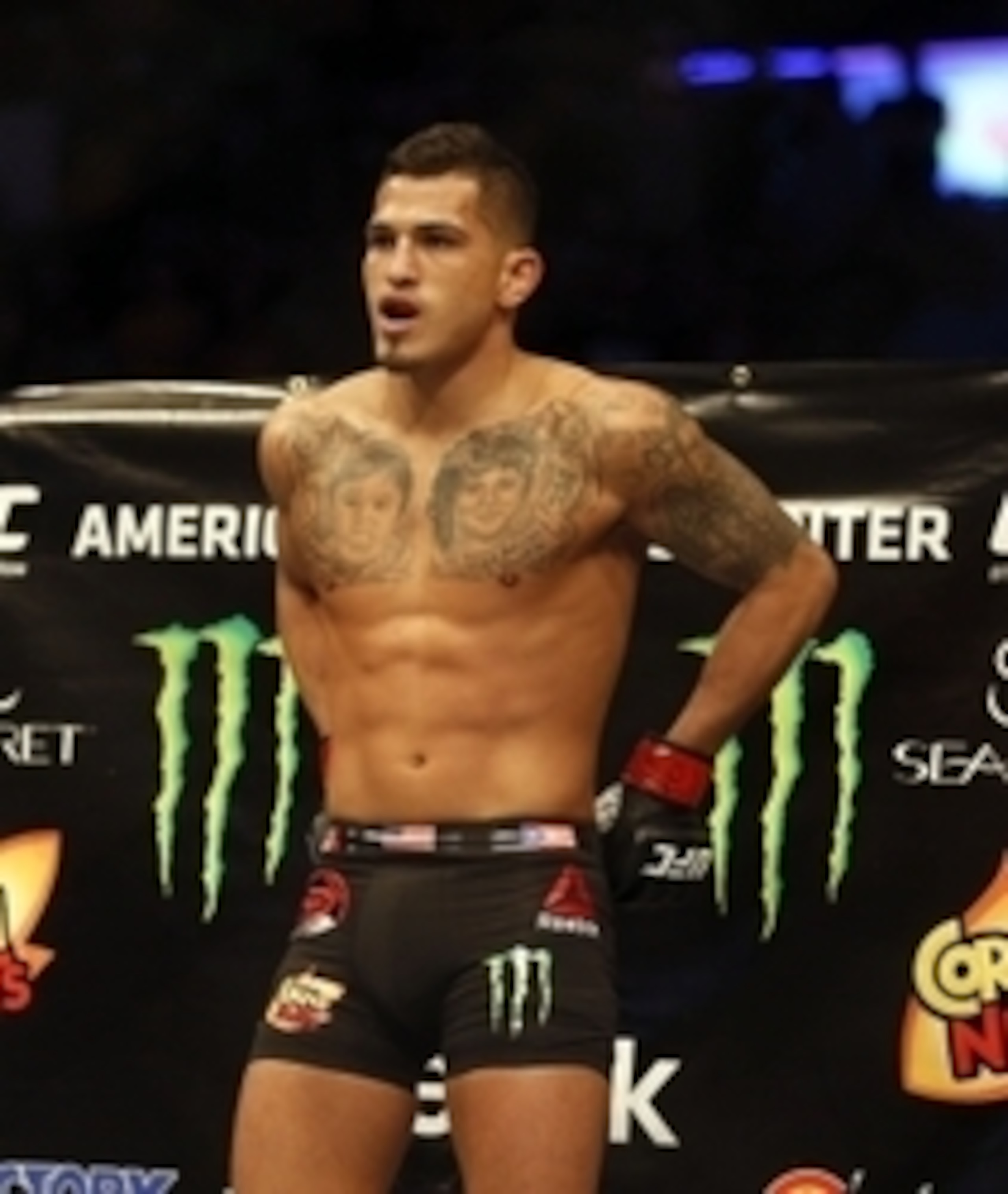 Anthony Pettis needs a big win to prove he hasn't lost a step. Anthony Pettis needs a big win to prove he hasn't lost a step.