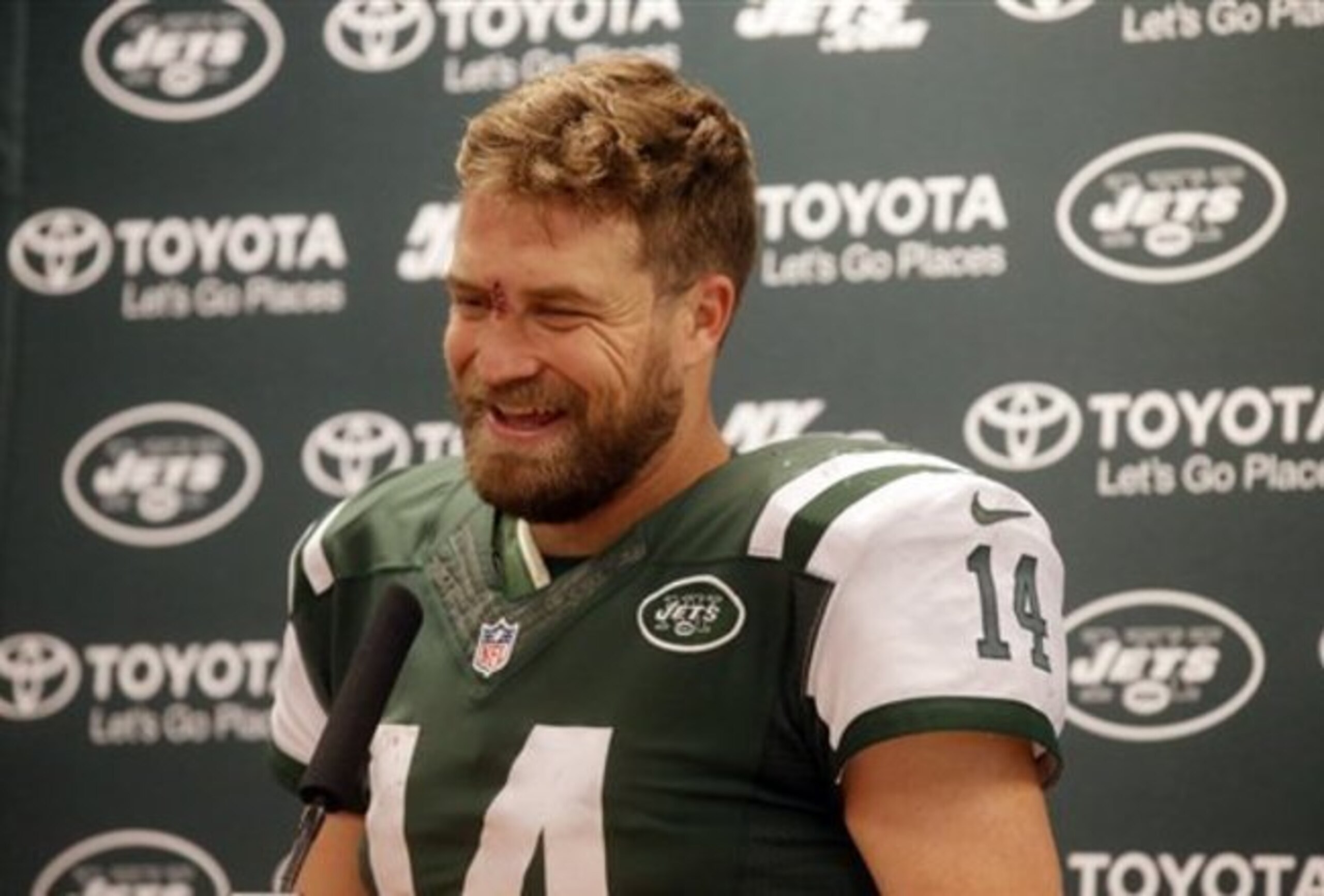 Ryan Fitzpatrick laughs about his injured nose.