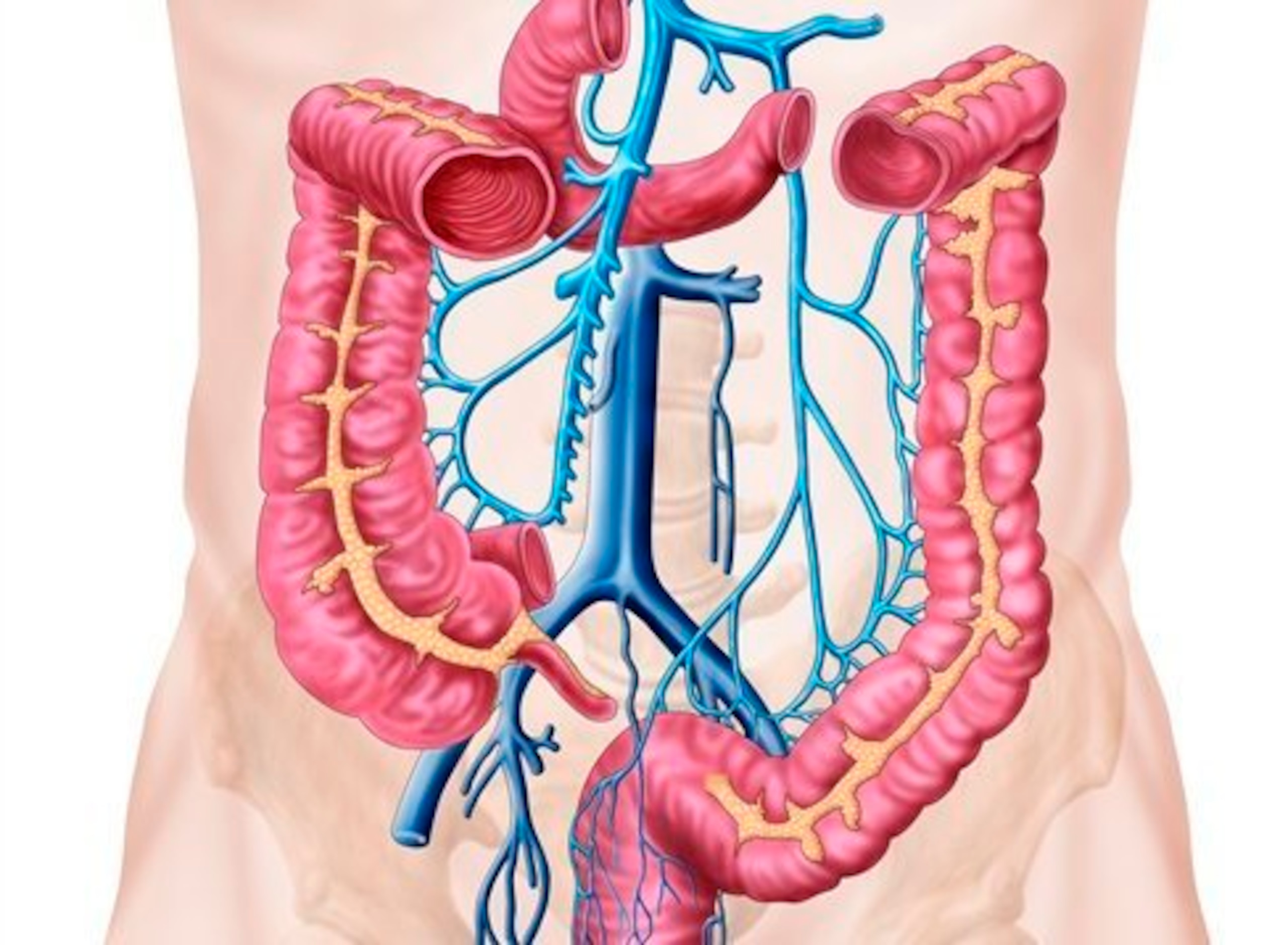 Not Brock Lesnar's actual colon.