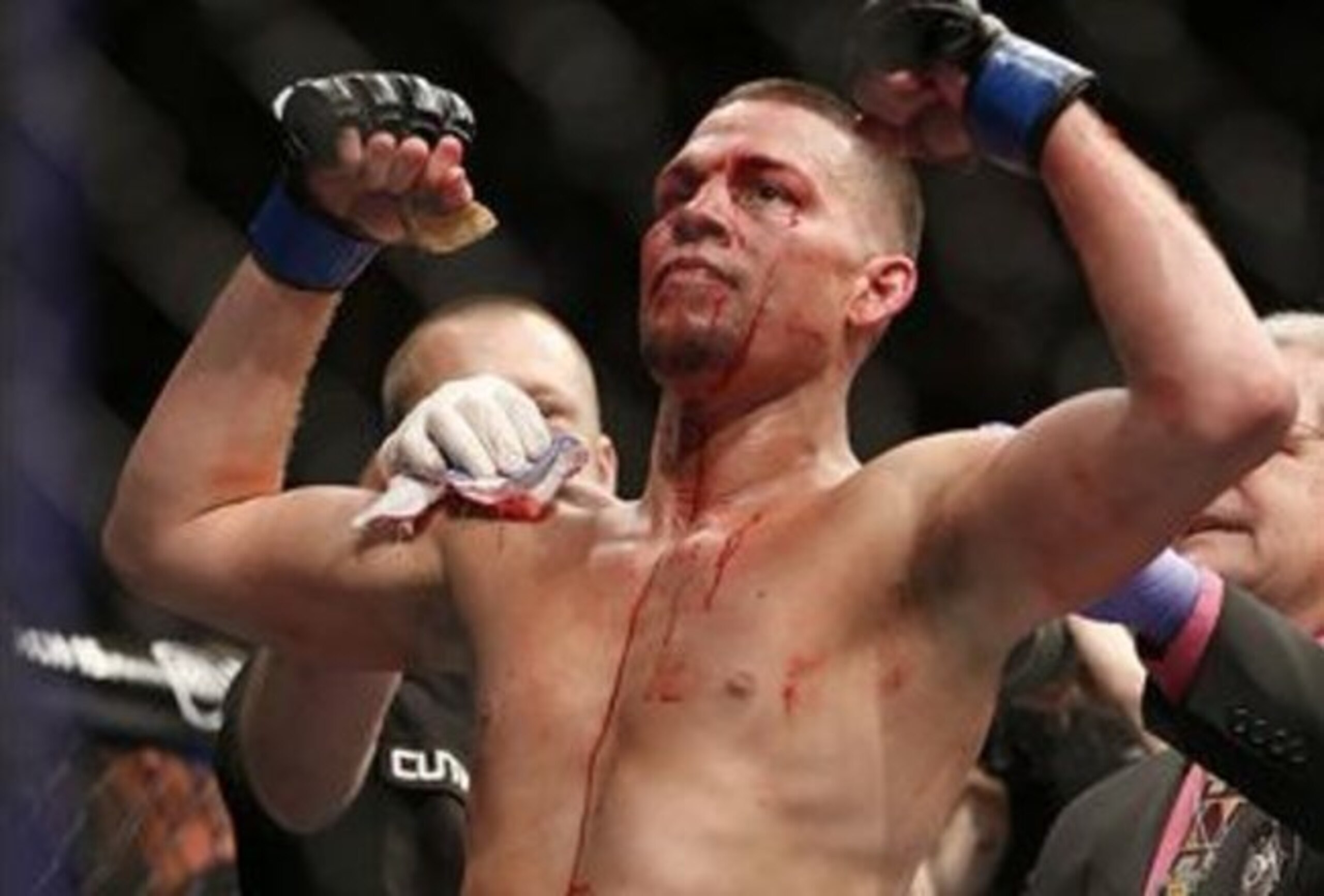 Nate Diaz