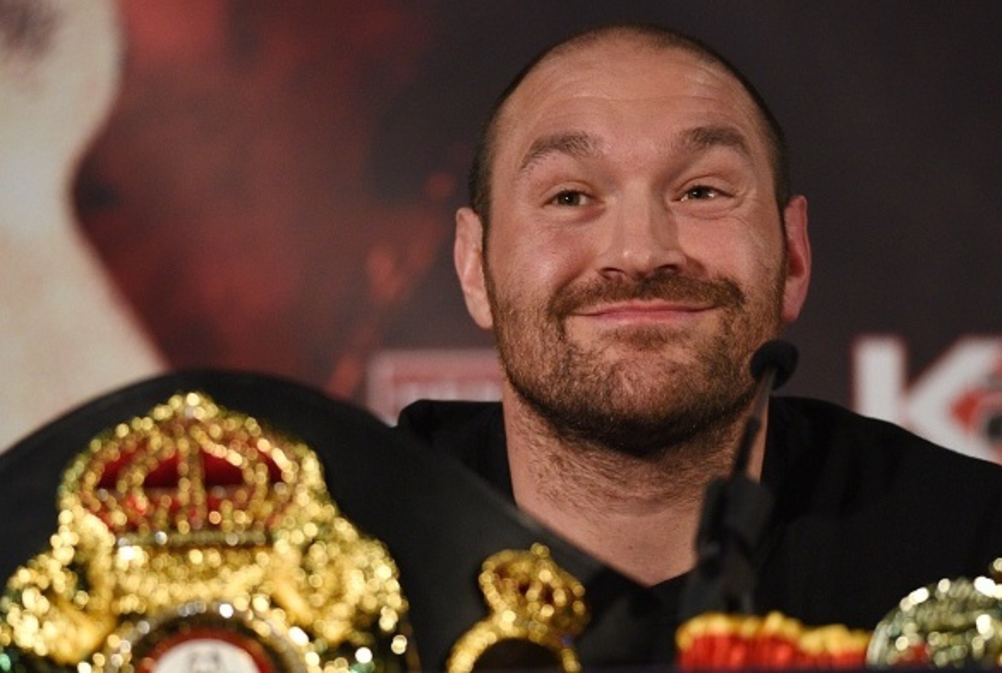 Love him or hate him, Tyson Fury's achievements should earn your respect.