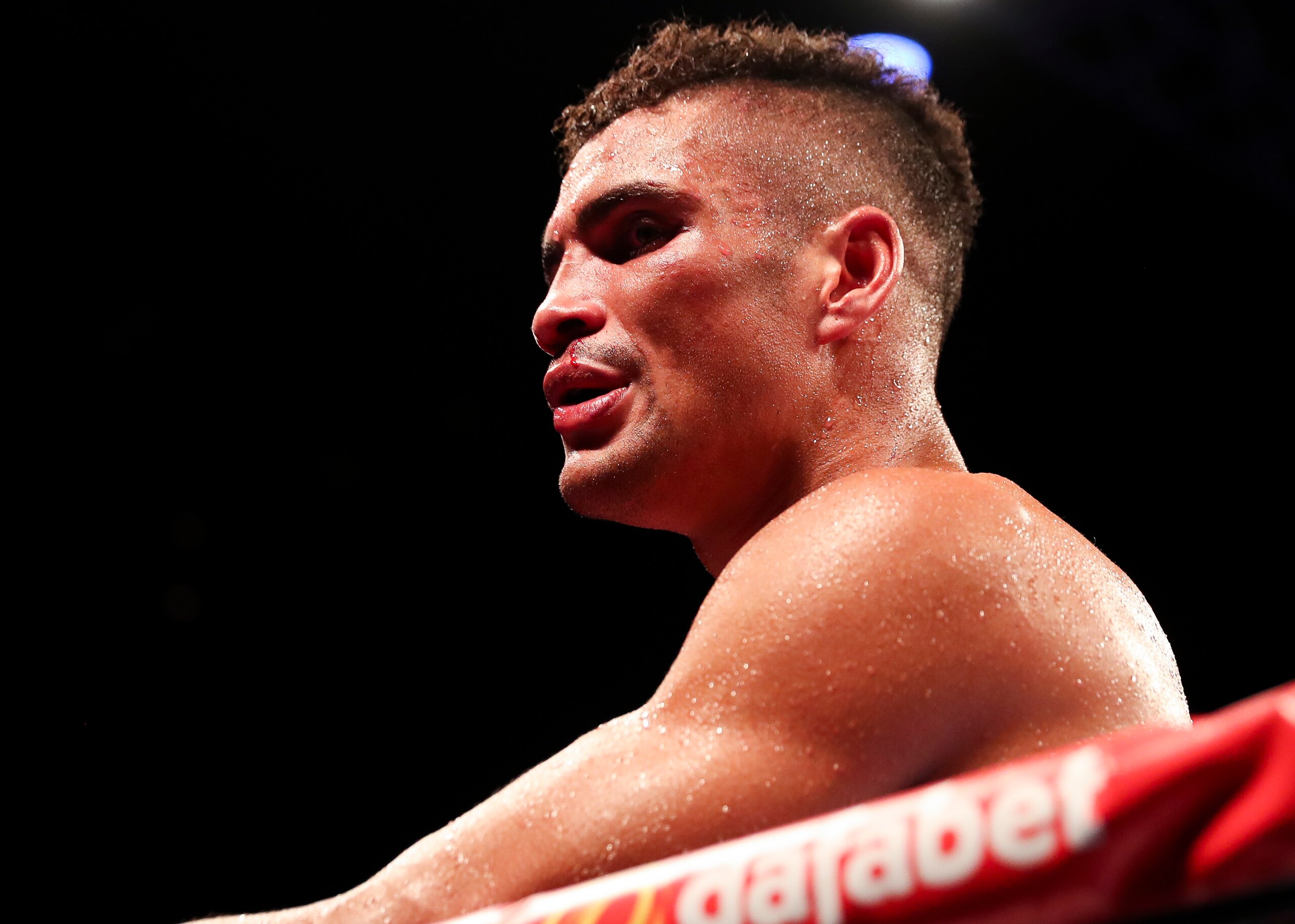 Anthony Ogogo suffered a first career defeat—and also picked up another injury.