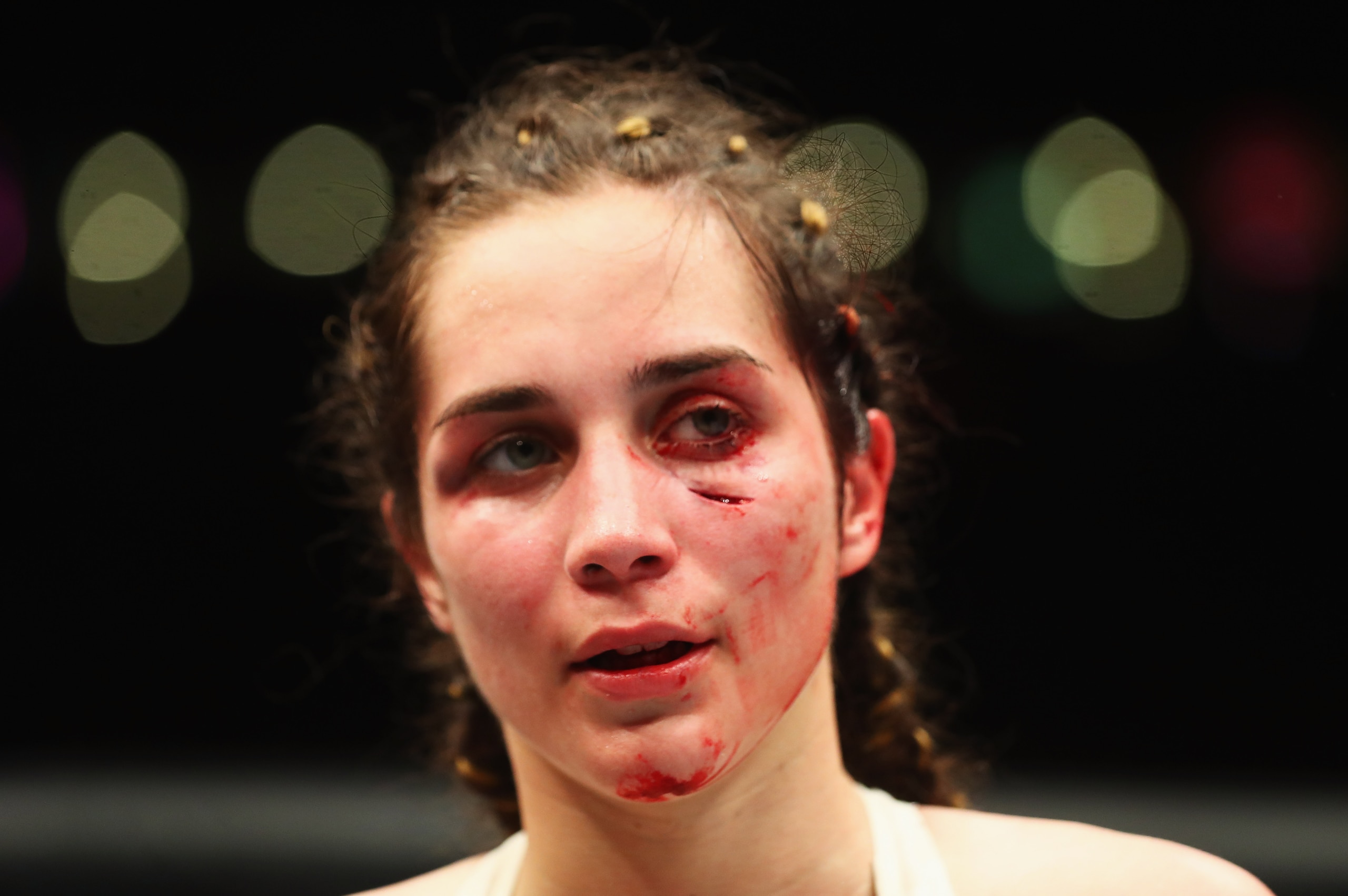 HAMBURG, GERMANY - SEPTEMBER 03:  Veronica Macedo of Venezuela appears frustrated after the fight between Ashlee Evans-Smith of the USA   in their Womens Bantamweight Bout during the UFC Fight Night held at Barclaycard Arena on September 3, 2016 in Hambur