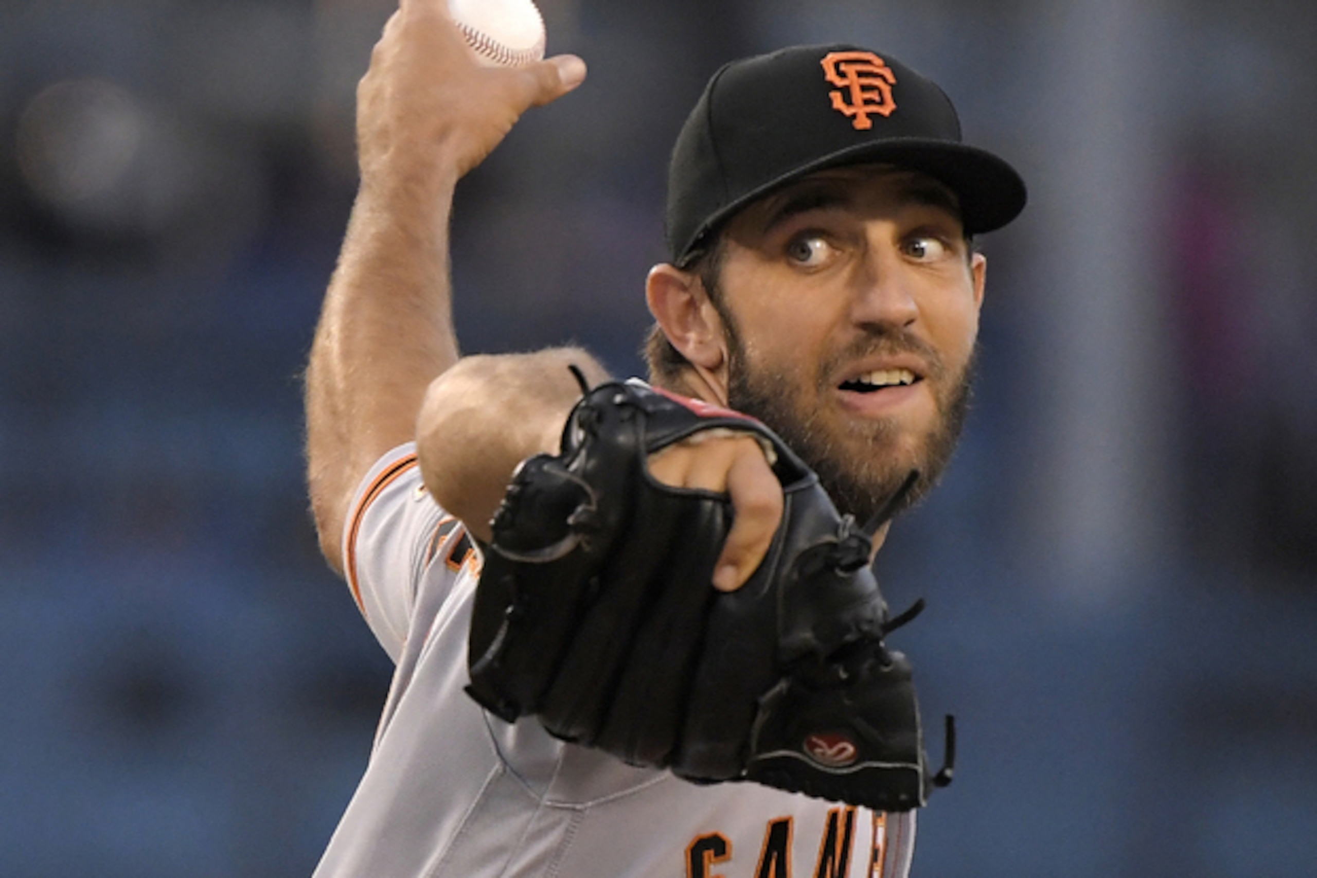 Many teams would look better with Madison Bumgarner.